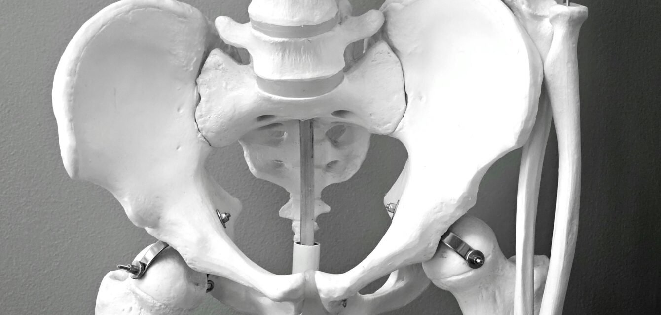 Tailor Surgery - displasia de cadera adultos - estudio digital 3D