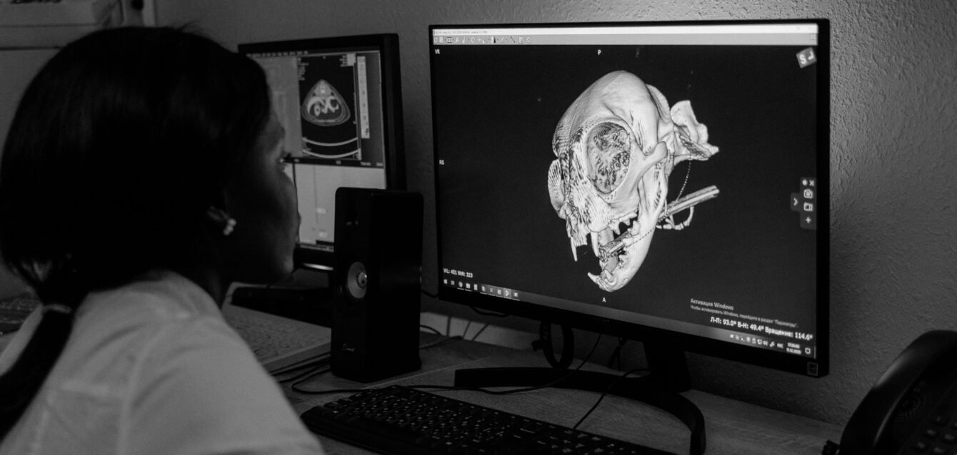 TAILOR SURGERY - diagnóstico 3D cadera - Estudio digital