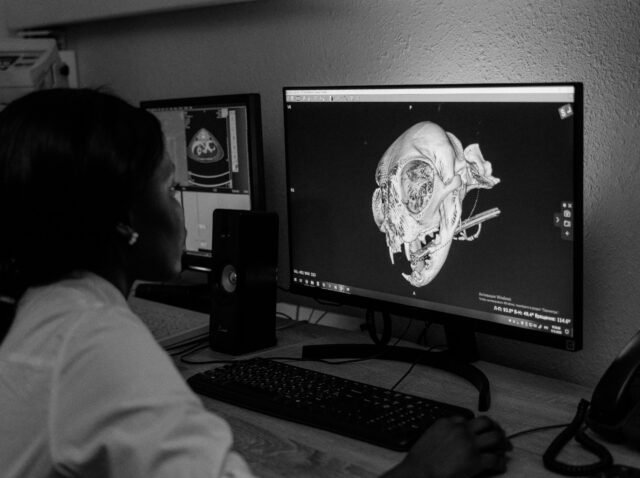 TAILOR SURGERY - diagnóstico 3D cadera - Estudio digital